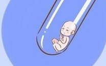 过来的人能说柳州妇幼医院试管婴儿怎么样吗？